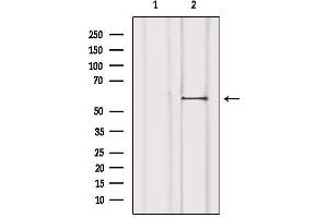 Western blot analysis of extracts from 293, using Estrogen Receptor-beta Antibody.