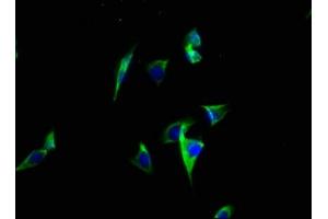 Immunofluorescence staining of A549 cells with ABIN7146408 at 1:100, counter-stained with DAPI. (ATP2C2 anticorps  (AA 621-702))