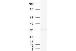 Validation with Western Blot