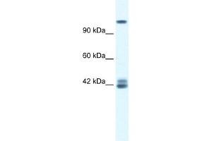 WB Suggested Anti-GRIN2C Antibody Titration:  0. (GRIN2C anticorps  (N-Term))