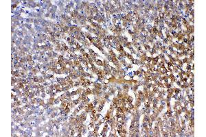 IHC analysis of PON1 using anti-PON1 antibody .