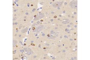 Immunohistochemistry analysis of paraffin-embedded rat brain using VMAT2 (ABIN7075655) at dilution of 1: 1600