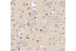 Immunohistochemistry analysis of paraffin-embedded rat brain using VMAT2 (ABIN7075655) at dilution of 1: 1600 (SLC18A2 anticorps)
