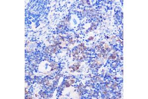 Immunohistochemistry of paraffin-embedded mouse spleen using CD24 Rabbit pAb (ABIN1512696, ABIN3023213, ABIN3023214 and ABIN6219443) at dilution of 1:100 (40x lens). (CD24 anticorps  (AA 1-80))