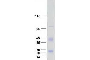 Validation with Western Blot