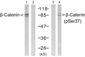 Western blot analysis of extract from SW 626 cells, using β-Catenin (Ab-37) antibody (E021212, Lane 1 and 2) and β-Catenin (phospho-Ser37) antibody (E011219, Lane 3 and 4). (beta Catenin anticorps  (pSer37))