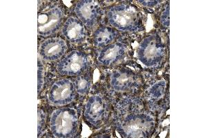 IHC analysis of AKAP12 using anti-AKAP12 antibody (ABIN7601563). (AKAP12 anticorps  (AA 387-1620))