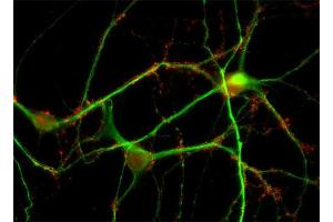Indirect immunofluorescence labeling of PFA fixed rat hippocampus neurons with anti-synaptogyrin (dilution 1 : 500; red) and anti-MAP 2 (, dilution: 1 : 500; green).