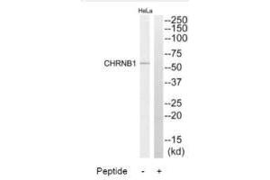 Western blot analysis of extracts from HeLa cells, using CHRNB1 antibody. (CHRNB1 anticorps  (N-Term))
