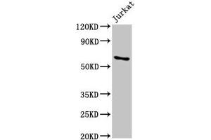 Western Blot Positive WB detected in: Jurkat whole cell lysate All lanes: IGF2BP1 antibody at 5. (IGF2BP1 anticorps  (AA 440-534))