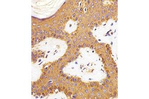 Immunohistochemical analysis of paraffin-embedded H.