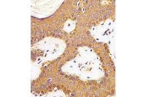 Immunohistochemical analysis of paraffin-embedded H. (RAC1 anticorps)