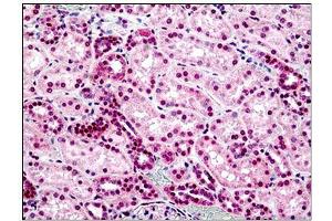 Human Kidney: Formalin-Fixed, Paraffin-Embedded (FFPE) (STEAP2 anticorps  (AA 455-467))