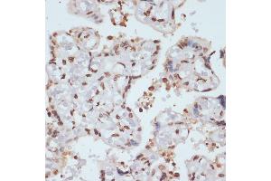 Immunohistochemistry of paraffin-embedded human placenta using Phospho-Chk1-S280 antibody (ABIN3019445, ABIN3019446, ABIN3019447 and ABIN6225372) at dilution of 1:100 (40x lens). (CHEK1 anticorps  (pSer280))