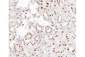 ABIN6267407 at 1/200 staining human kidney tissue sections by IHC-P.