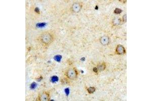 Immunohistochemical analysis of VILIP-1 staining in mouse brain formalin fixed paraffin embedded tissue section.