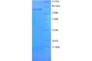 Small Nuclear Ribonucleoprotein Polypeptide A (SNRPA) (AA 8-278), (partial) protein (GST tag)
