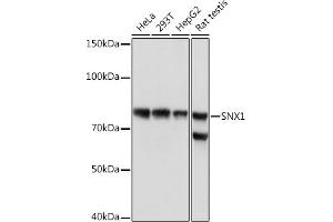 Western blot analysis of extracts of various cell lines, using SNX1 Rabbit mAb (ABIN7270502) at 1:1000 dilution. (Sorting Nexin 1 anticorps)