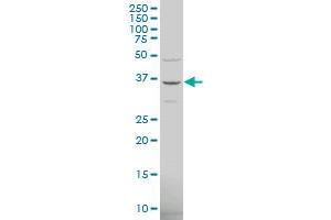 TRIM6-TRIM34 polyclonal antibody (A01), Lot # 051115JCO1 Western Blot analysis of TRIM6-TRIM34 expression in Hela S3 NE .