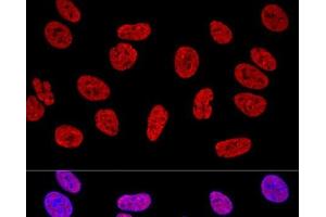 Confocal immunofluorescence analysis of U2OS cells using KHDRBS1 Polyclonal Antibody at dilution of 1:400.