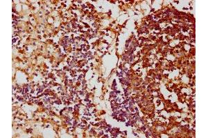 IHC image of ABIN7152658 diluted at 1:100 and staining in paraffin-embedded human lymph node tissue performed on a Leica BondTM system. (FCRL3 anticorps  (AA 122-222))