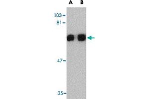 Western blot analysis of PRDM1 in A-549 cell lysate with PRDM1 polyclonal antibody  at (A) 0. (PRDM1 anticorps  (C-Term))