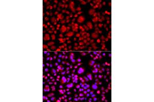Immunofluorescence analysis of A549 cell using TP53BP2 antibody. (TP53BP2 anticorps)