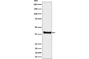 Western blot analysis of ALS2CR1 expression in LNCaP cell lysate.