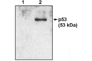 Western Blotting (WB) image for anti-Tumor Protein P53 (TP53) (AA 371-380) antibody (ABIN264449) (p53 anticorps  (AA 371-380))