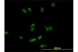 Immunofluorescence of monoclonal antibody to CSE1L on HeLa cell. (Exportin 2 anticorps  (AA 872-971))