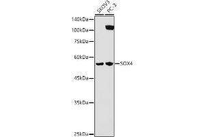 Western blot analysis of extracts of various cell lines, using SOX4 antibody (ABIN7270575) at 1:1000 dilution.