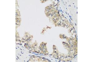 Immunohistochemistry of paraffin-embedded human prostate using RRM1 antibody at dilution of 1:200 (40x lens). (RRM1 anticorps)