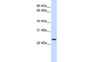 WB Suggested Anti-PRRG3 Antibody Titration:  0. (PRRG3 anticorps  (N-Term))