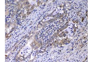 IHC analysis of Relaxin 1 using anti-Relaxin 1 antibody .