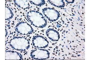 Image no. 13 for anti-Polo-Like Kinase 1 (PLK1) antibody (ABIN1500282)