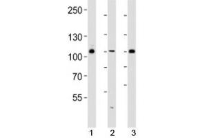 Western blot analysis of lysate from 293, HUVEC, T47D cell line (left to right) using GAB1 antibody diluted at 1:1000 for each lane. (GAB1 anticorps  (AA 250-285))