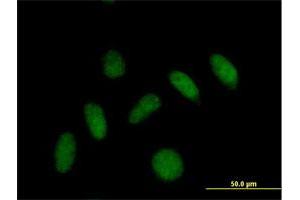 Immunofluorescence of purified MaxPab antibody to PLEKHJ1 on HeLa cell. (GNRPX anticorps  (AA 1-149))