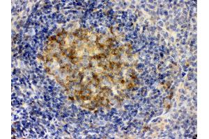 Anti- SQSTM1 Picoband antibody,IHC(P) IHC(P): Rat Spleen Tissue