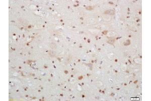 Formalin-fixed and paraffin embedded mouse brain labeled with Rabbit Anti-CIRBP Polyclonal Antibody, Unconjugated (ABIN872483) at 1:200 followed by conjugation to the secondary antibody and DAB staining
