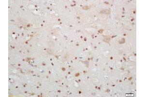 Formalin-fixed and paraffin embedded mouse brain labeled with Rabbit Anti-CIRBP Polyclonal Antibody, Unconjugated (ABIN872483) at 1:200 followed by conjugation to the secondary antibody and DAB staining (CIRBP anticorps  (AA 61-172))