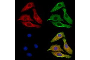 ABIN6256040 and ABIN6267417 staining H2O2 treated Hela cells by IF/ICC.