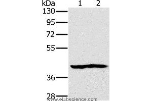 Western blot analysis of Mouse heart and kidney tissue, using NDUFA10 Polyclonal Antibody at dilution of 1:450 (NDUFA10 anticorps)