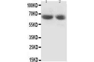 Anti-GAD65 antibody, Western blotting Lane 1: Rat Brain Tissue Lysate Lane 2: Rat Brain Tissue Lysate (GAD65 anticorps  (N-Term))