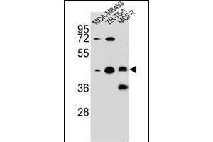 hCG_1645727 Antibody (C-term) (ABIN656073 and ABIN2845421) western blot analysis in MDA-M,ZR-75-1,MCF-7 cell line lysates (35 μg/lane). (KBTBD13 anticorps  (C-Term))