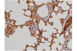 ABIN6267385 at 1/200 staining Mouse lung tissue sections by IHC-P.