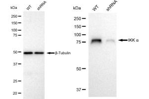 Western blotting analysis using IKK alpha antibody (ABIN7798146).
