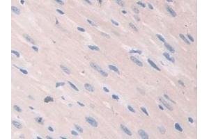 Detection of CARD9 in Mouse Heart Tissue using Polyclonal Antibody to Caspase Recruitment Domain Family, Member 9 (CARD9)