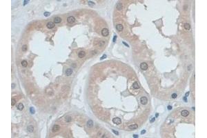 Detection of EZR in Human Kidney Tissue using Polyclonal Antibody to Ezrin (EZR)