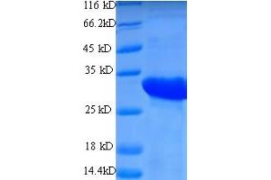 SDS-PAGE (SDS) image for HLA-DR-gamma (CD74) (AA 57-280), (Extracellular) protein (His tag) (ABIN5709247)