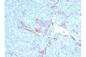 Formalin-fixed, paraffin-embedded human Tonsil stained with TIM3 Mouse Monoclonal Antibody (TIM3/3113). (TIM3 anticorps  (AA 22-202))
